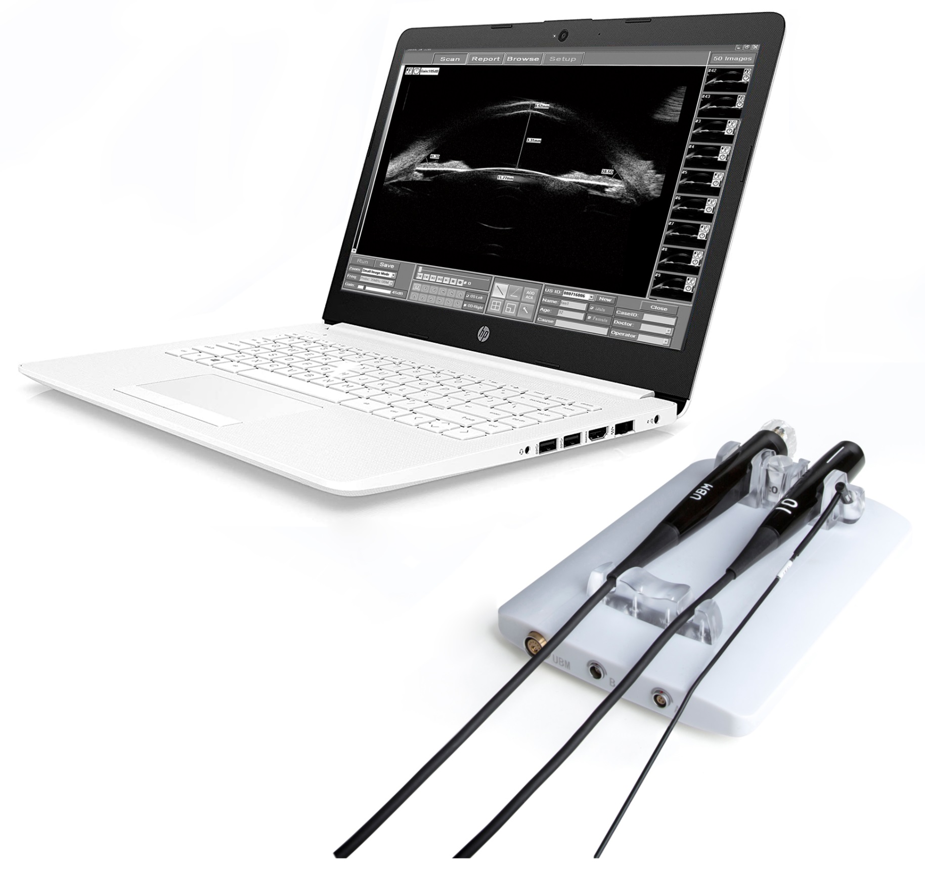 Suoer-sw-21-delta-scan-modular-and-upgreatable-ultrasound-instrument-device